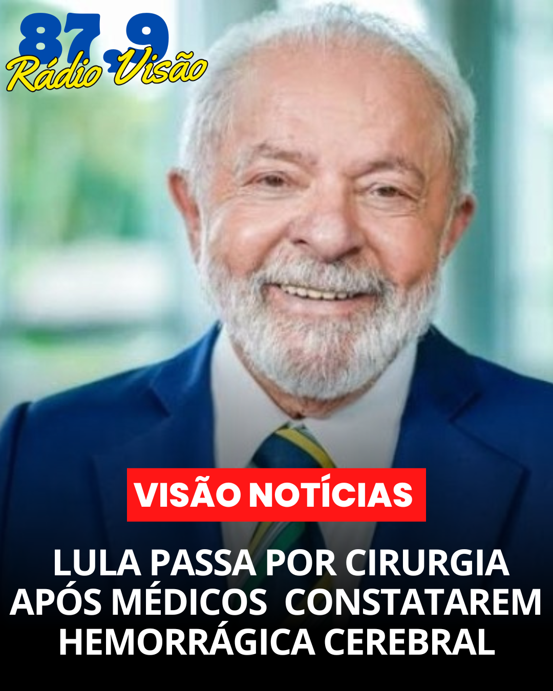 ​Lula passa por cirurgia após médicos constatarem hemorragia cerebral